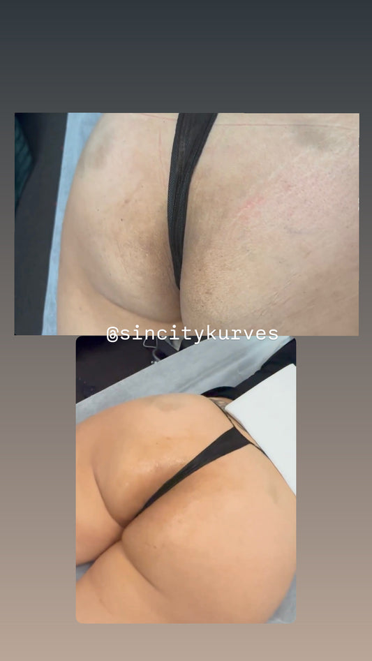 Skin Lightening Session